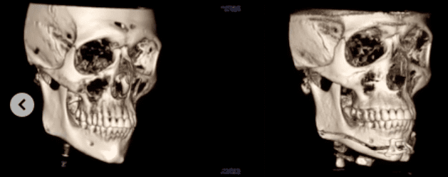 Ct 34