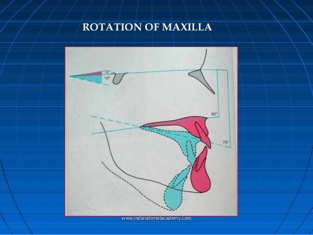 Growth rotations 31 638