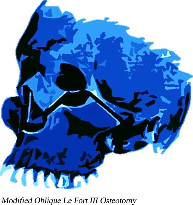 12663 2016 893 Figa HTML