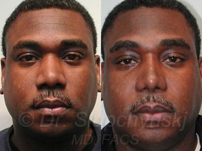 632DAFEC 06DE 4319 B68D ABD080CC9645