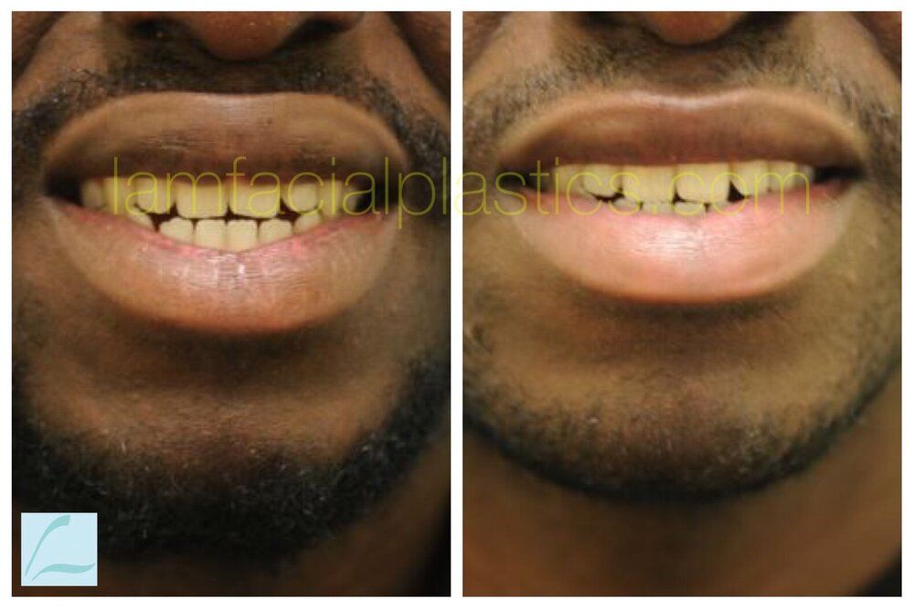 D0E6FD63 A9B2 48E5 81D0 60A280AB0AF9