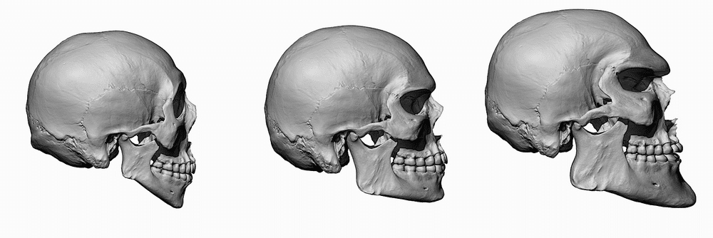Chad Male Skull