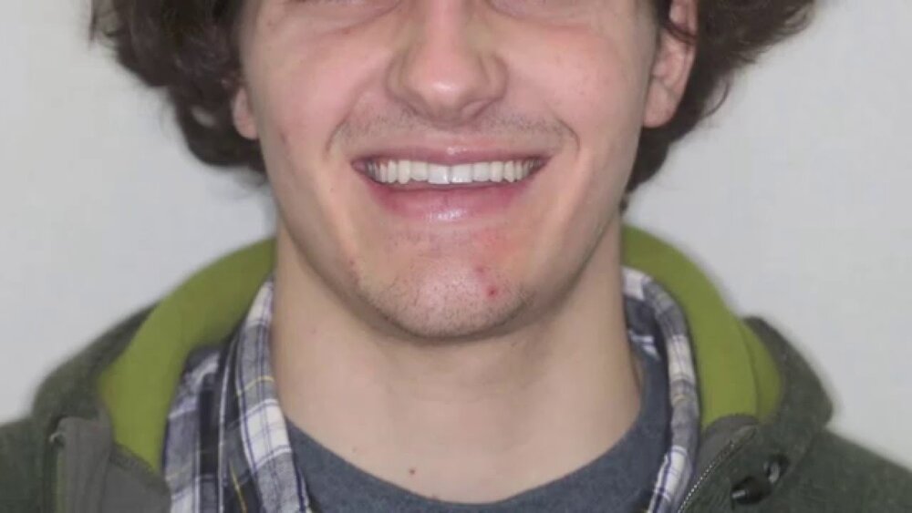 Maxresdefault
