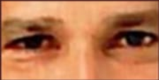 Eyearea