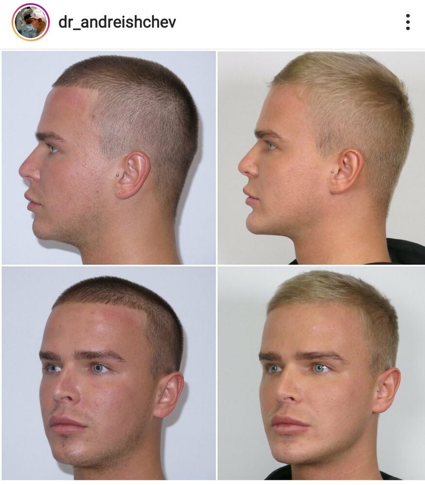 SmartSelect 20200620 154630 Instagram