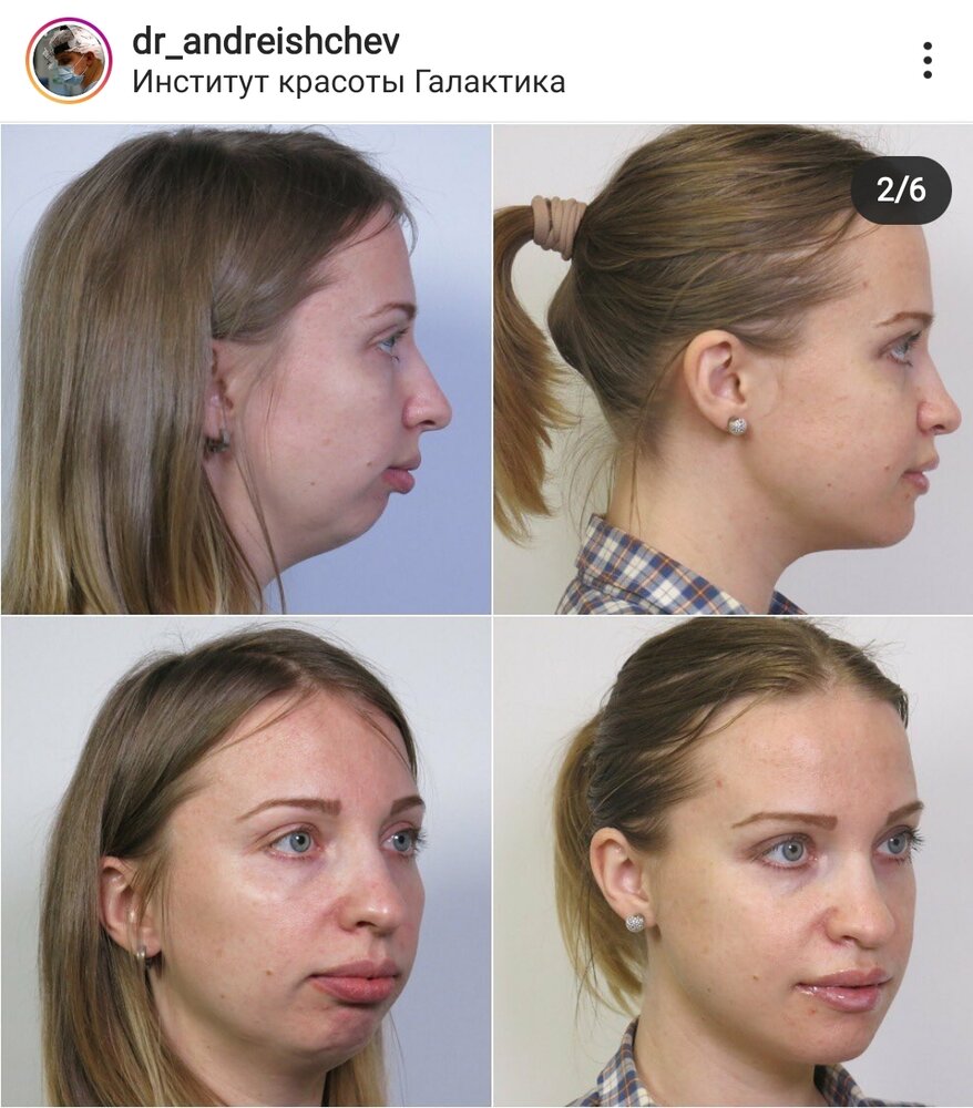 SmartSelect 20200620 154550 Instagram