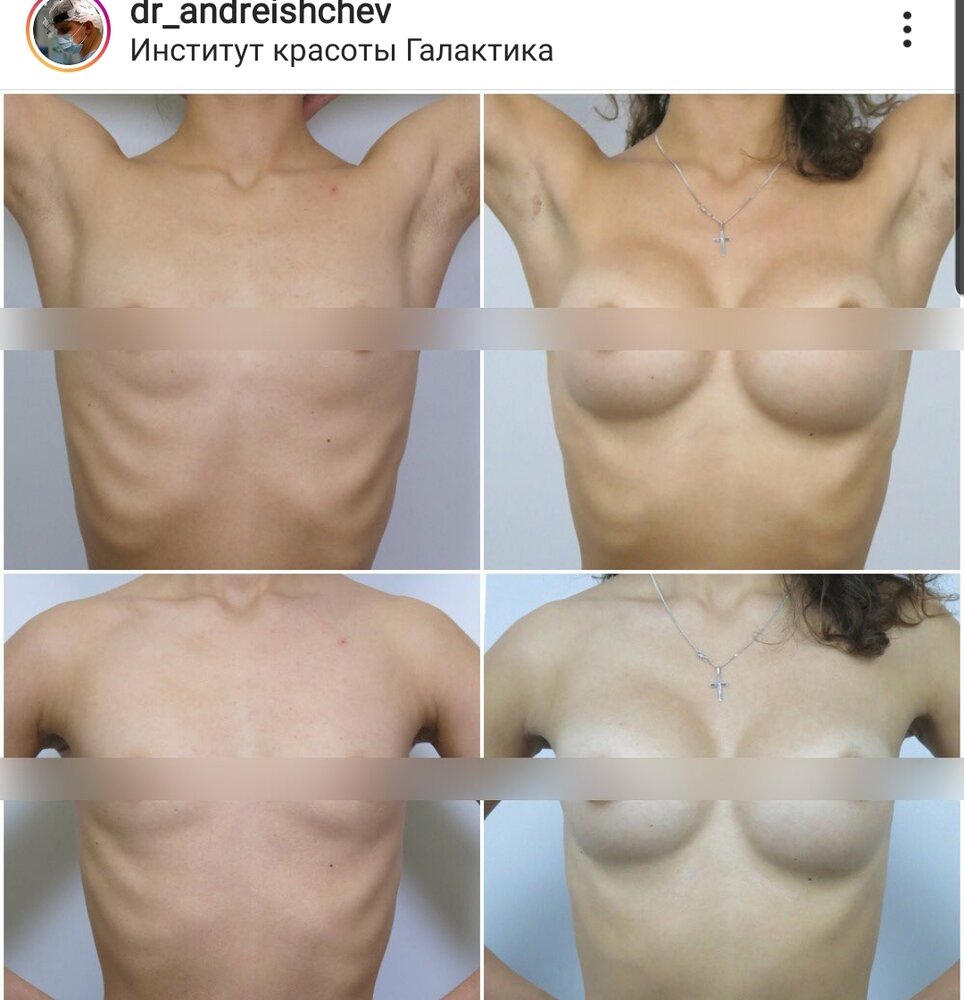 SmartSelect 20200620 154724 Instagram