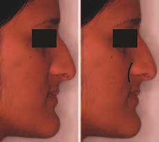 Facial aesthetics2 024