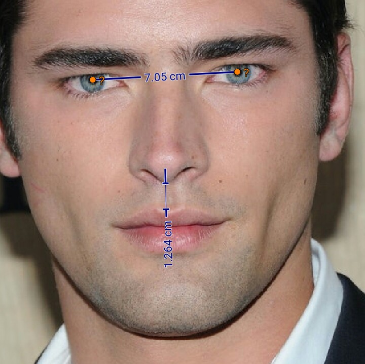 Philtrum