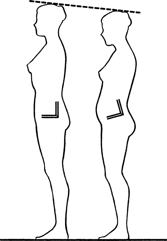 PostureFoundationGarments04fig1
