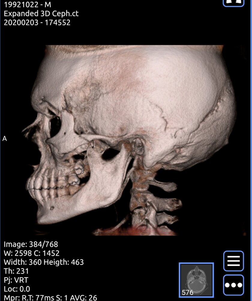 20200628 102642