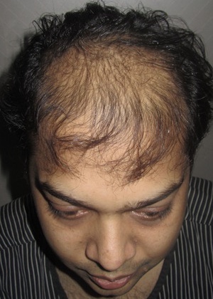 591E978A 14C2 4104 919A 6AED593CDF3E