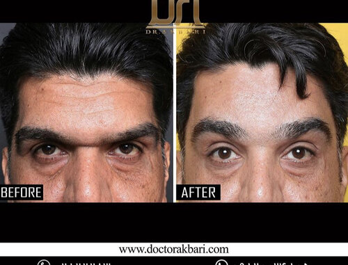 BA206FFB 19ED 4D3A 91E8 77F07EBD387B