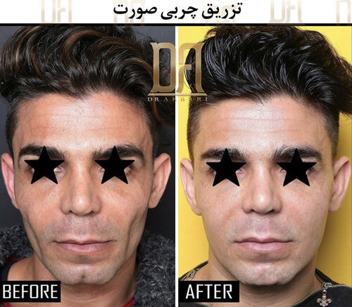 F30D37EF 093C 4DE7 AF55 1E1C55B5AEB4