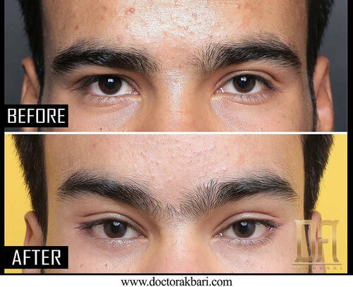 E69BF44B E97A 4494 974E F8753A2ADCC3