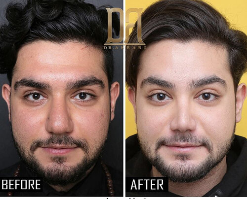 E64B7FE7 FA4B 497C 83B4 044A762FB0F4