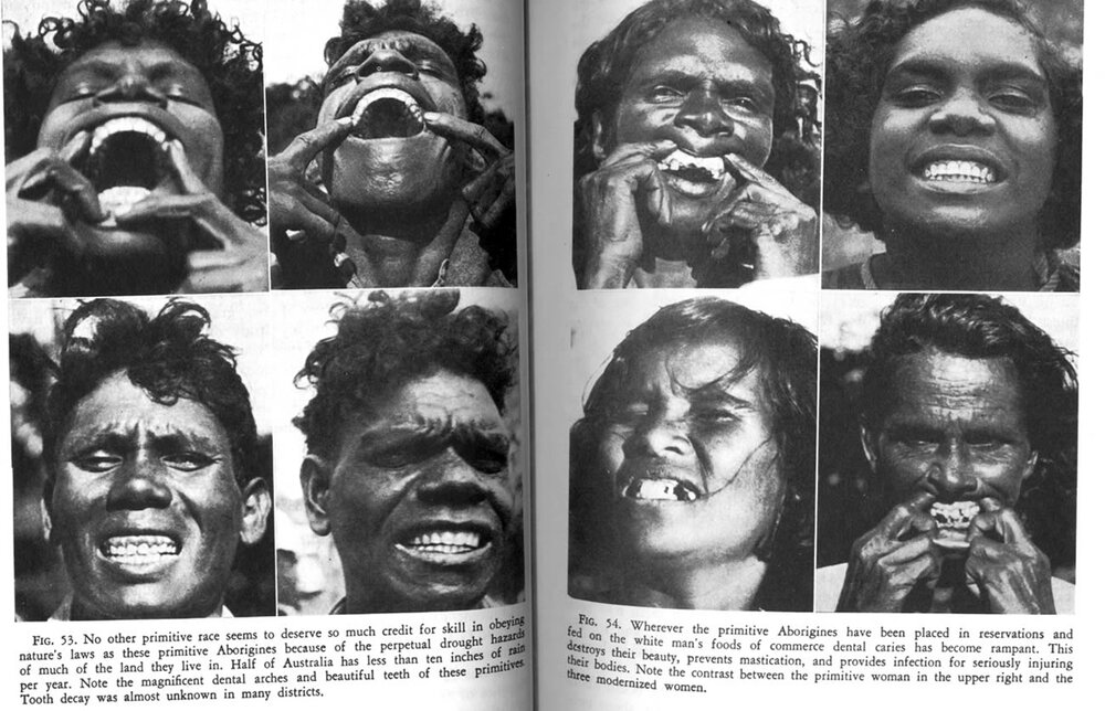 Aborigines