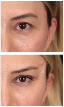 Brow2 Brow2