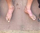 Chad feet