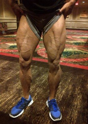 Massive legs