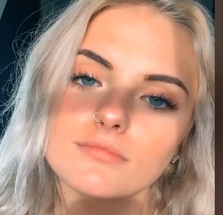 Midface