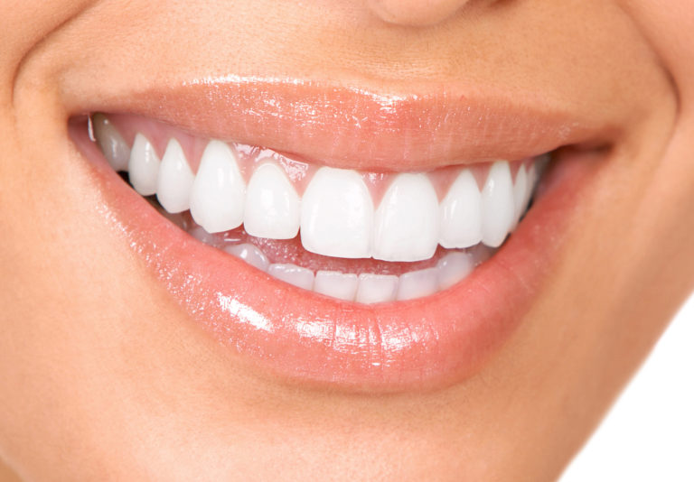 White smilee