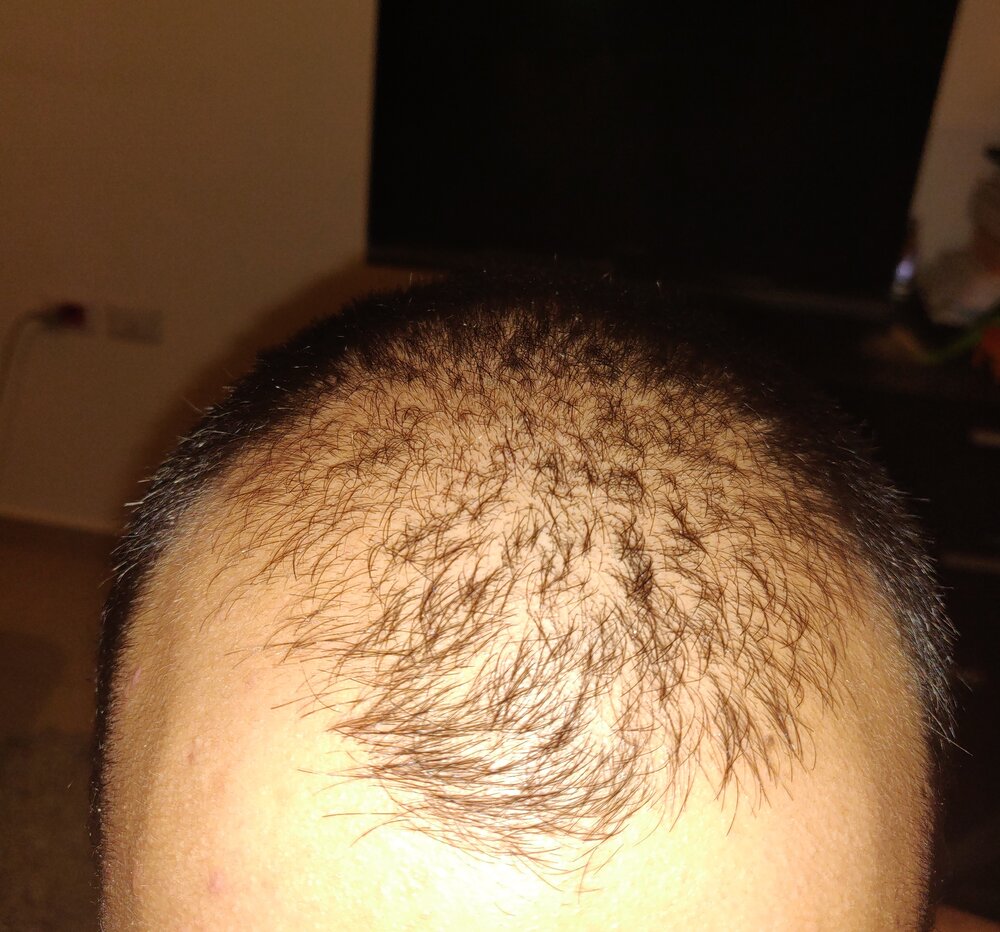 IMG 20200703 230537  01