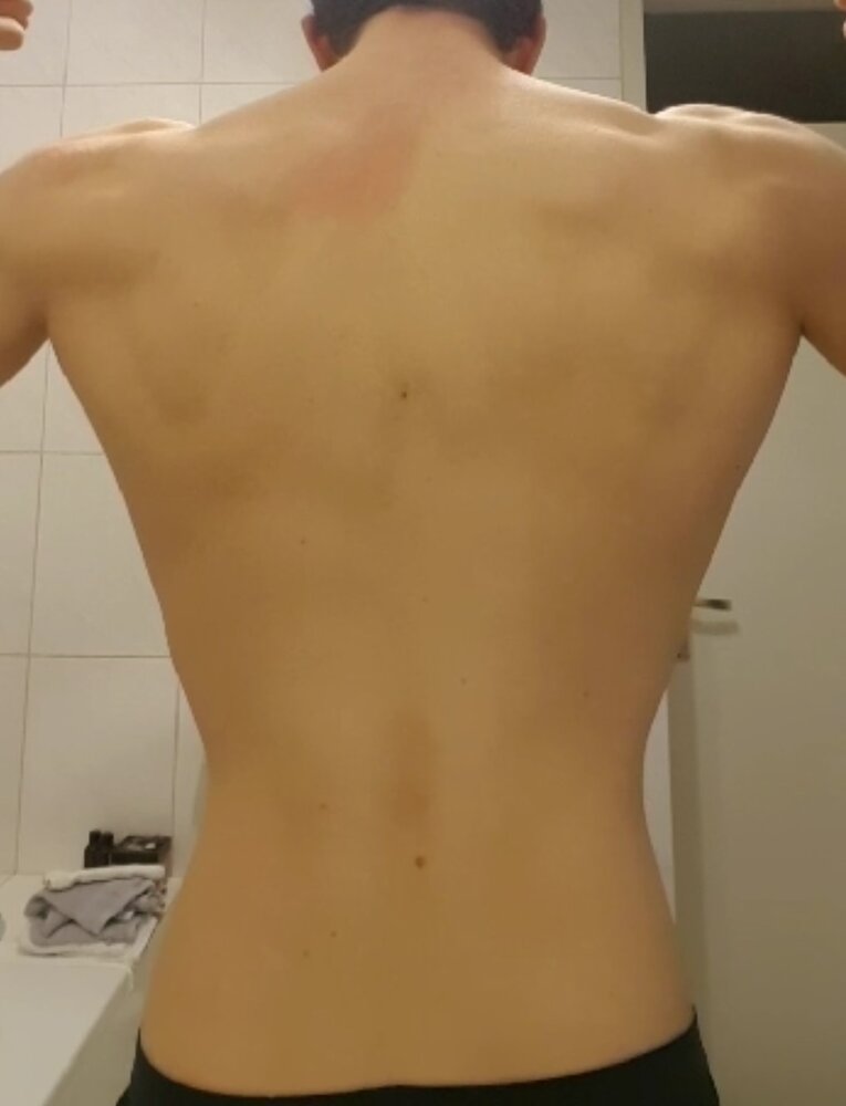 Back3