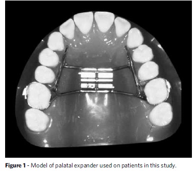 A22fig01 1