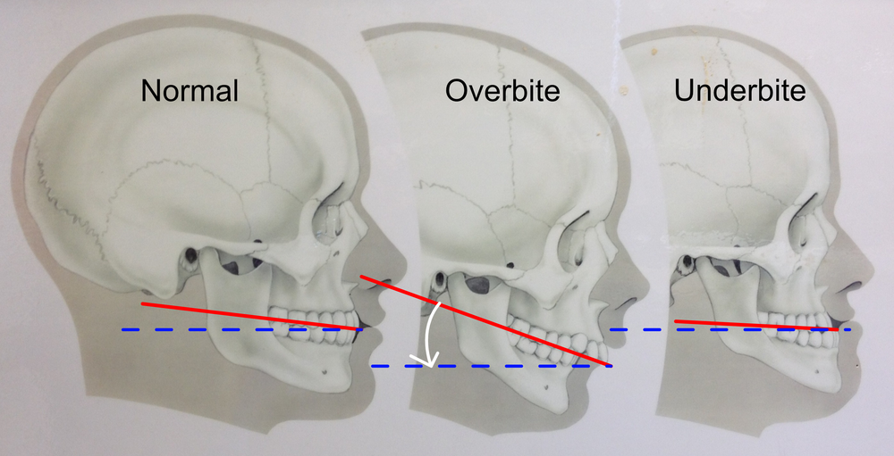 Threeskulls
