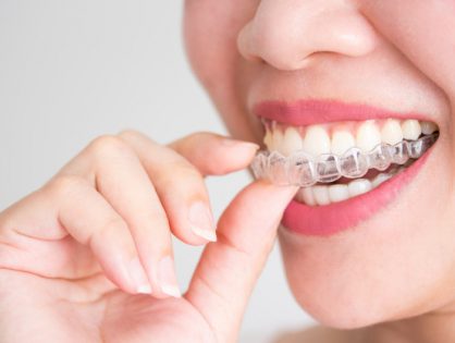 Usmiechnieta kobieta trzyma invisalign lub niewidoczne szelki 43937 94 418x315