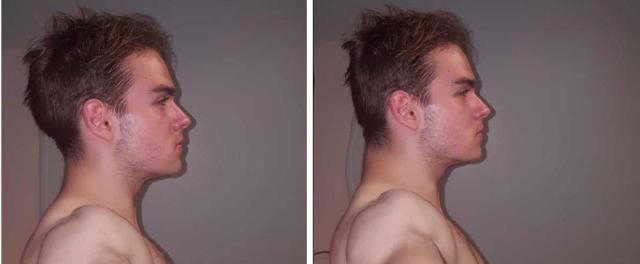 Occipital