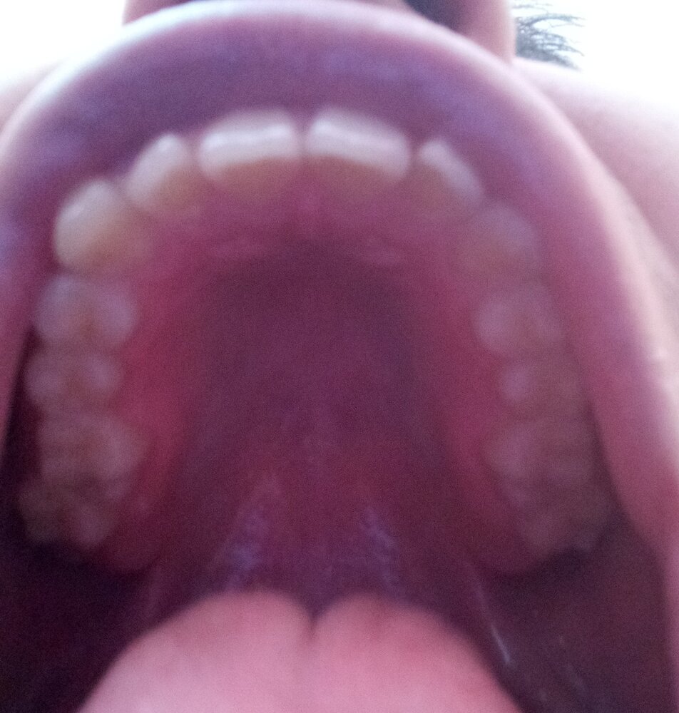 IMG 20200710 1308112