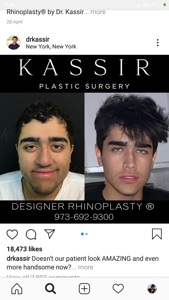 1594389050924