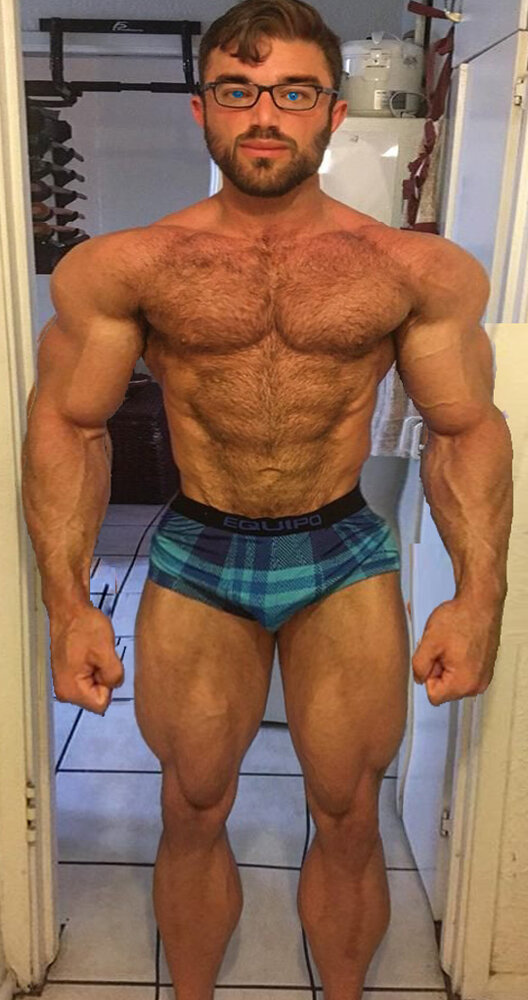 Manlet gymcelmoprh