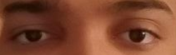 Eye area TRUECEL