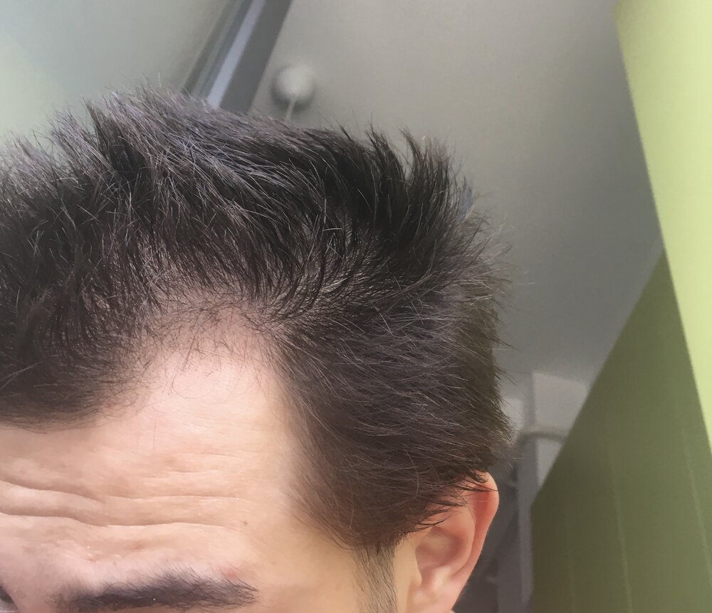 19A3B360 654F 4E5A 8164 84654ECF18B9