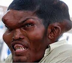 Images 3