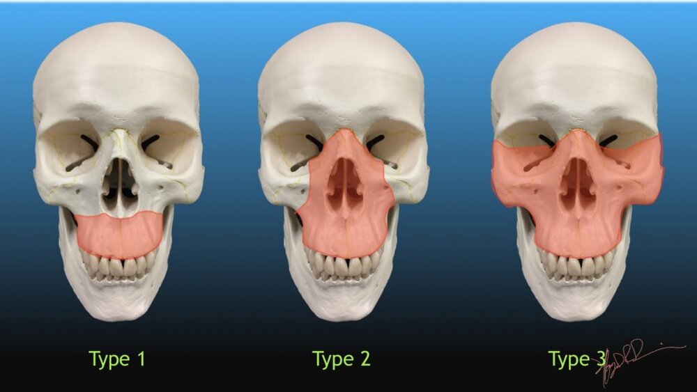 3D0D5C73 88E4 4AAB B16B 5CBD129C431E