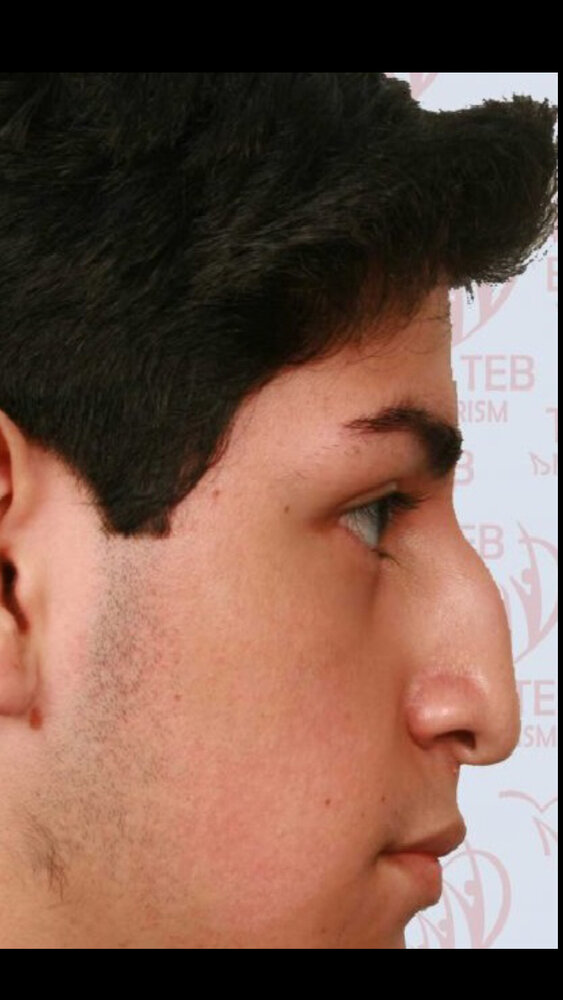 96F16CA5 0EF1 4361 9C76 AAE9040EFBA4