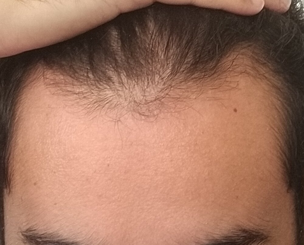 IMG 20200722 1023222