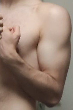 Arm