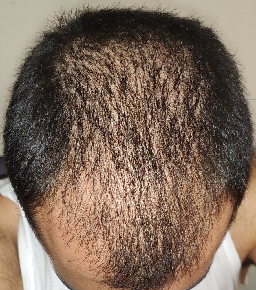 IMG 20200721 170443  01