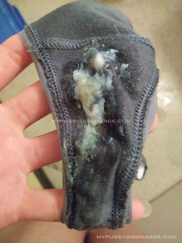 Vaginal discharge