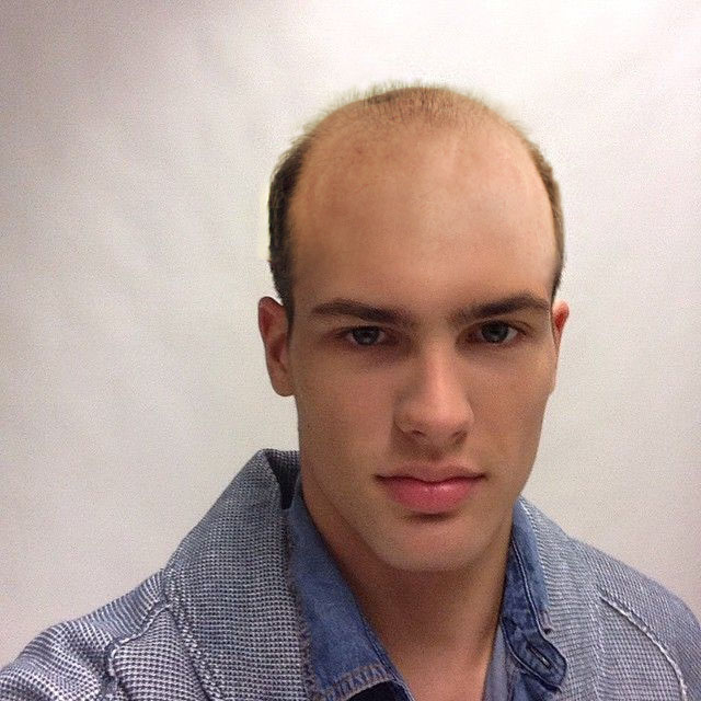 Bald model
