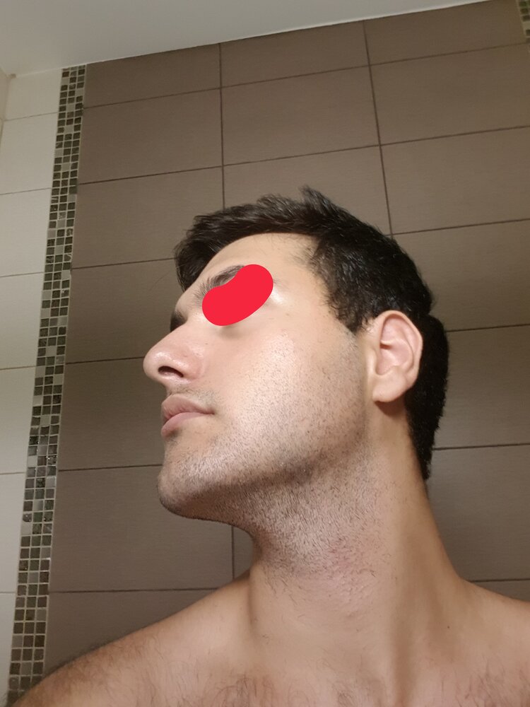 20180717 185715  01