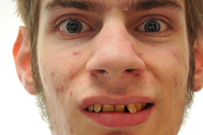 Dreamstime m 11658264