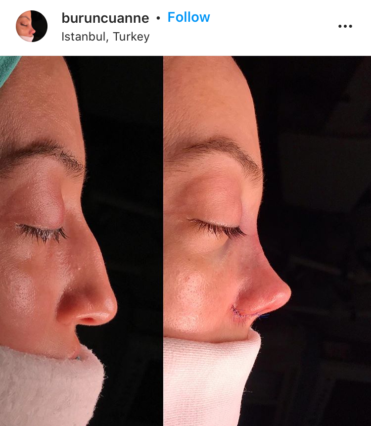 14A6296B E8EC 415A BDA2 CE1262C6FF9B