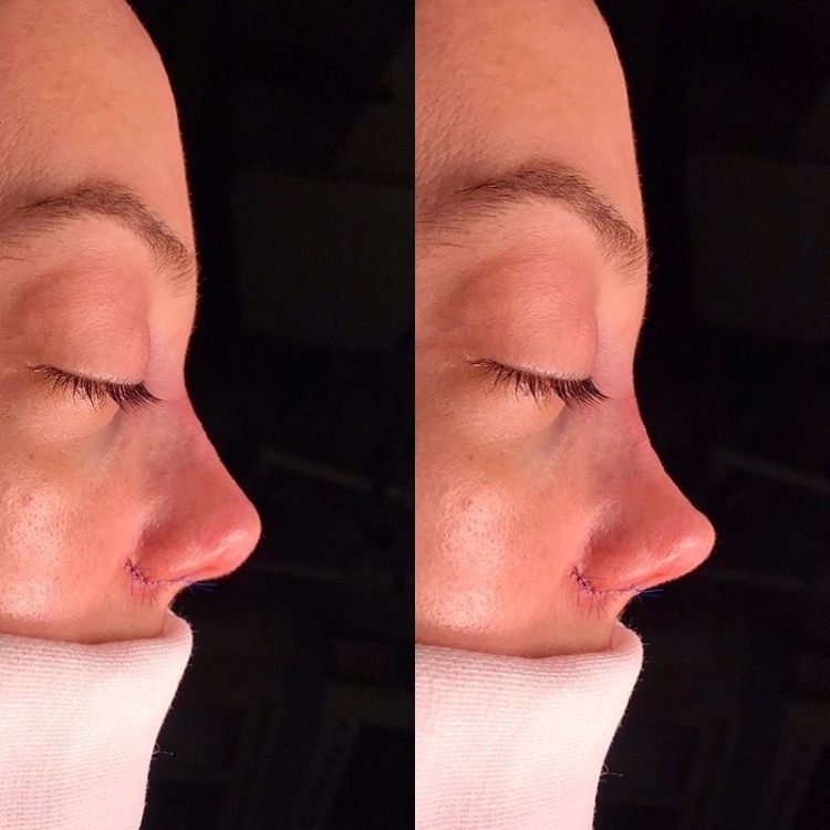 D91B2FEF C3CA 435C B5AF FE050EFE4AA6