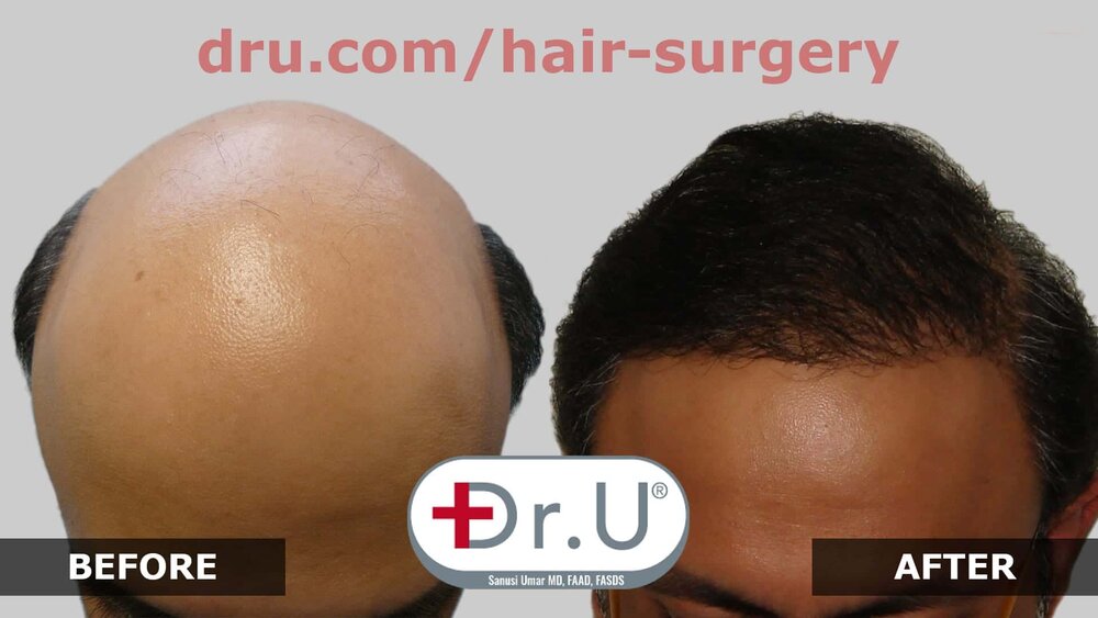 54DDC107 6ADA 45AC B476 4F63DBE1124B